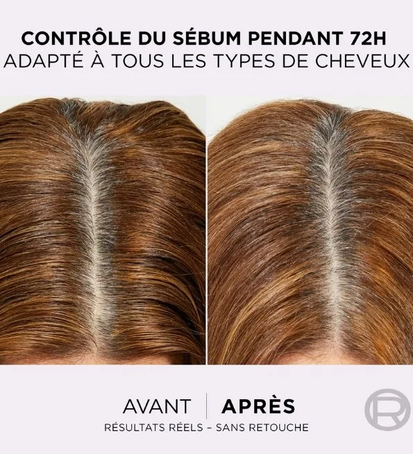 L’Oreal Paris Elseve Hyaluron Repulp Après Shampoing Démêlant Hydratation 200ml – Image 5