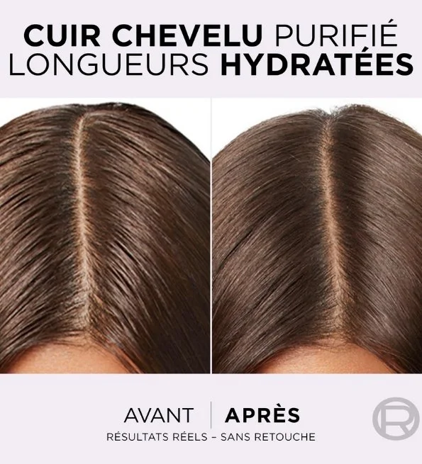 L’Oreal Paris Elseve Hyaluron Repulp Après Shampoing Démêlant Hydratation 200ml – Image 7