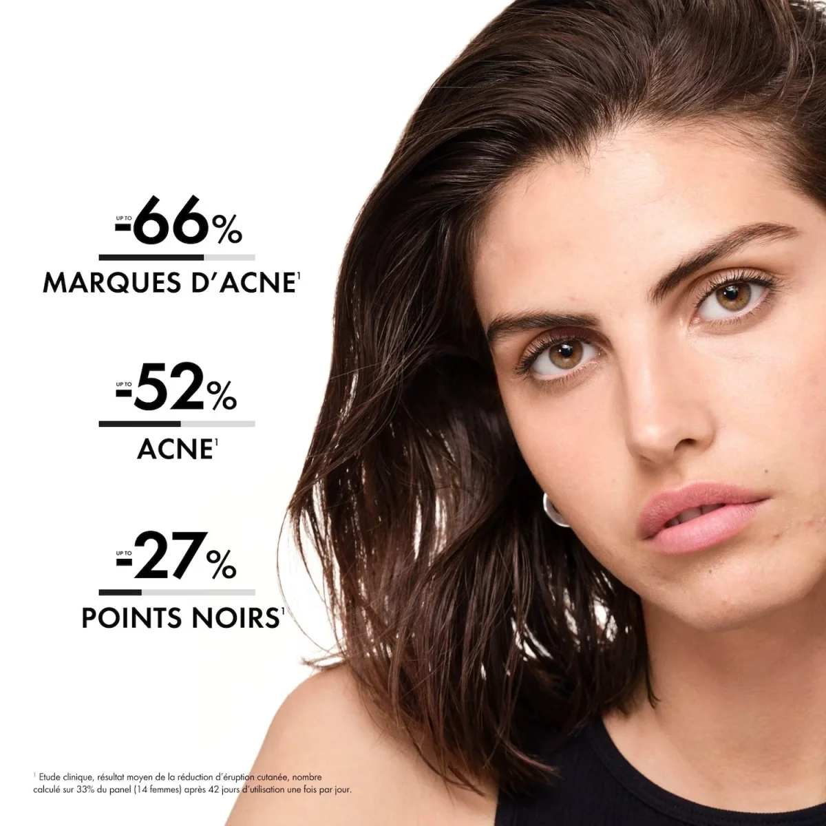 Vichy Normaderm Sérum Anti-imperfections PROBIO-BHA. Peau Grasse Acnéique | 30ml – Image 9